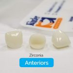 Zirconia-Anteriors.jpg